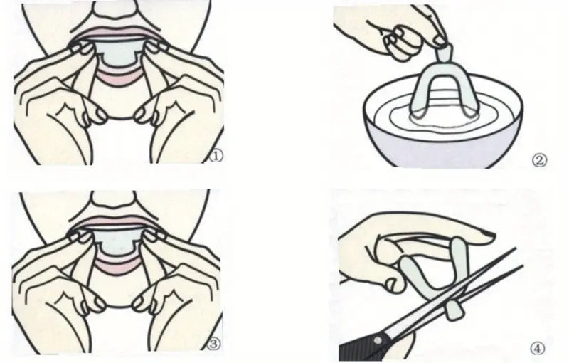 Professional Teeth Whitening Kit with Impression Tray & Guard