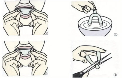 Professional Teeth Whitening Kit with Impression Tray & Guard